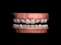 人类全副牙齿3d模型