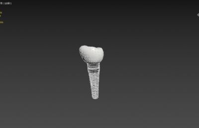 种植牙3dmax模型