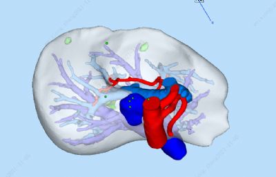 肝脏STL模型(内含肝动脉,静脉,门脉)