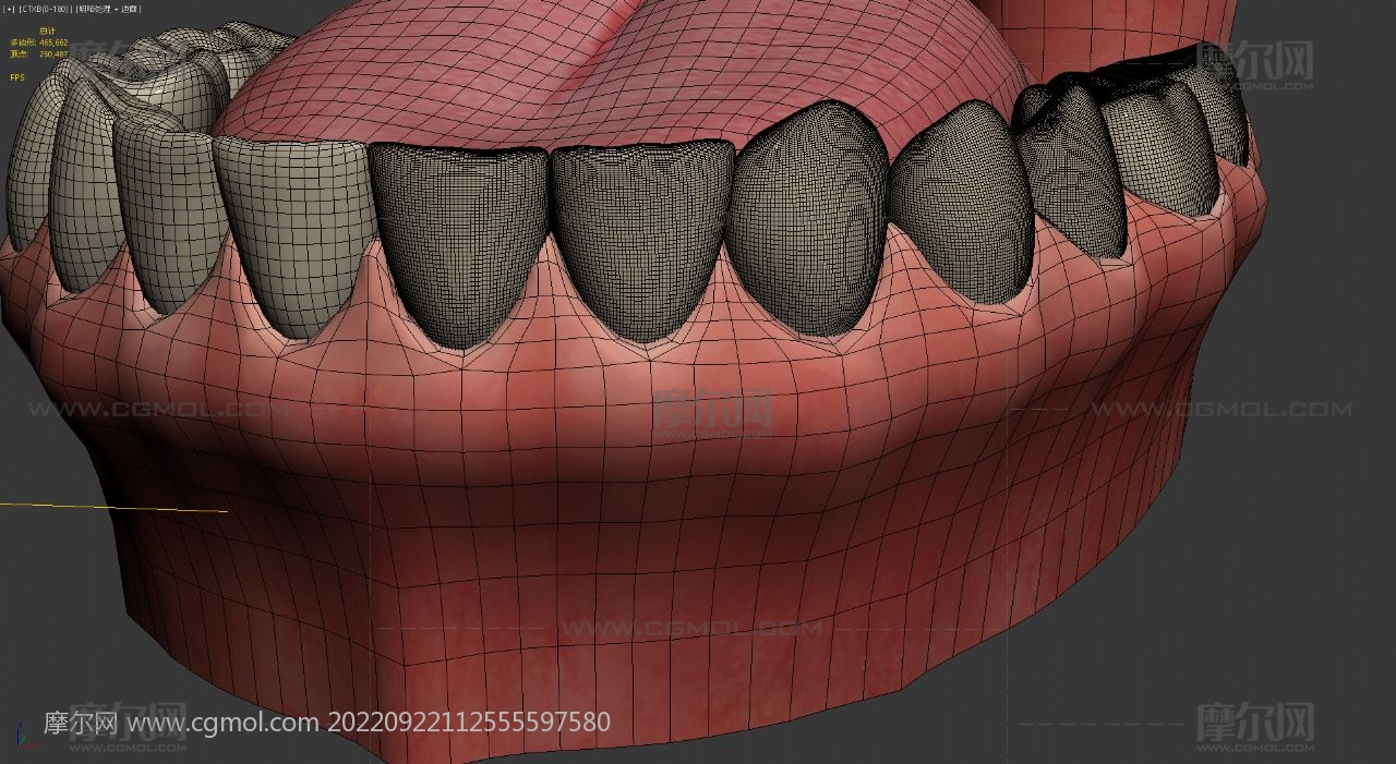 牙齿脱细胞手术,牙齿脱落3D模型动画