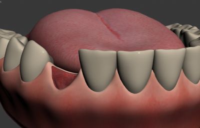 牙齿放入骨块缝合手术3D模型动画源文件