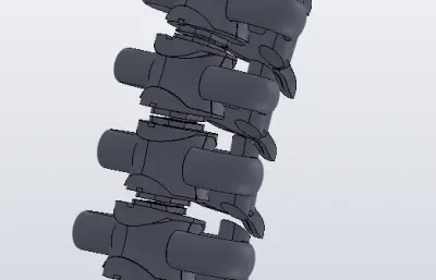 颈椎（脊椎）设计模型
